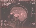 00MRI2.jpg